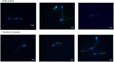 Variation of existence and location of aquaporin 3 in relation to cryoresistance of ram spermatozoa